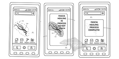 Motorola patent una pantalla que se repara a s misma